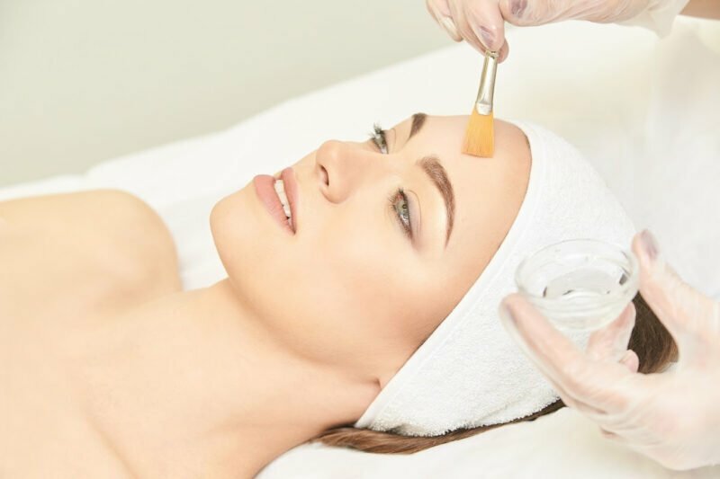 Getting a Chemical Peel? Here Are Some Tips to Prepare Before the Procedure